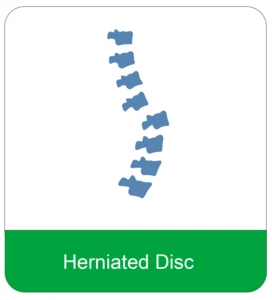 herniated